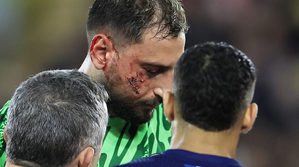 Uznemirujuće slike – Donarumi unakaženo lice FOTO/VIDEO